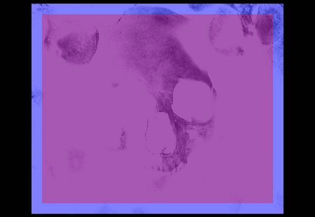 2psyched - Overkill (Spotify), Techno music genre, Nagamag Magazine